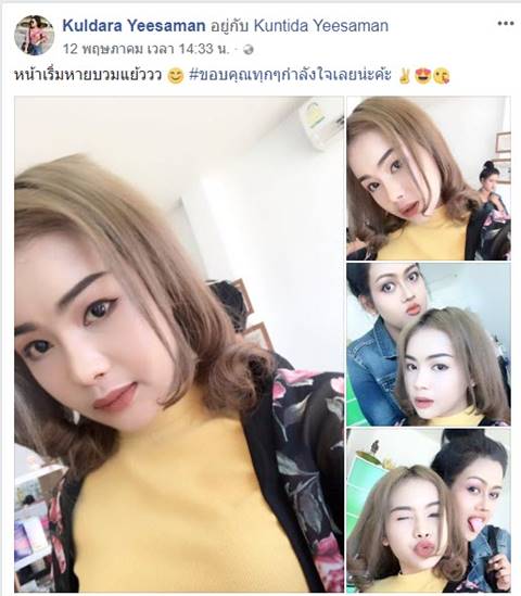 น้องนีต้า สาวถูก เอ็ม ชัยชนะ ทำร้ายอ่วม น้องนีต้า สาวถูก เอ็ม ชัยชนะ ทำร้ายอ่วม