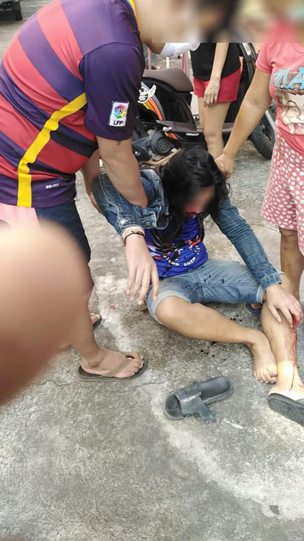 ทำร้ายร่างกาย ทำร้ายร่างกาย