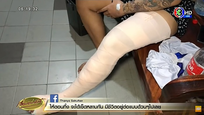 ทำร้ายร่างกาย ทำร้ายร่างกาย